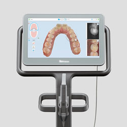 Leistungen 3D Scan & Aligner Systeme · Fachzahnarzt für Kieferorthopädie Witten Peter Brünger